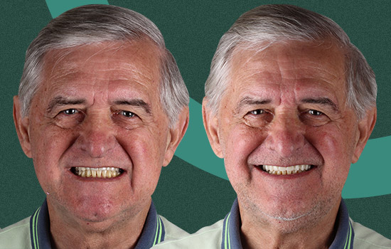 Casos - Wilson 01